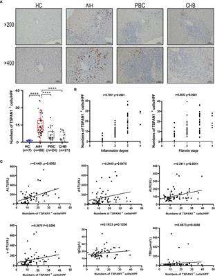 The immunological characteristics of TSPAN1 expressing B cells in autoimmune hepatitis